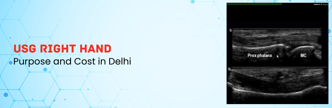  USG Right Hand: Purpose and Cost in Delhi